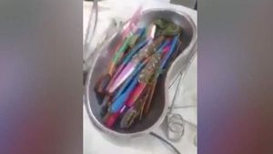 Молодой человек проглотил зубные щетки